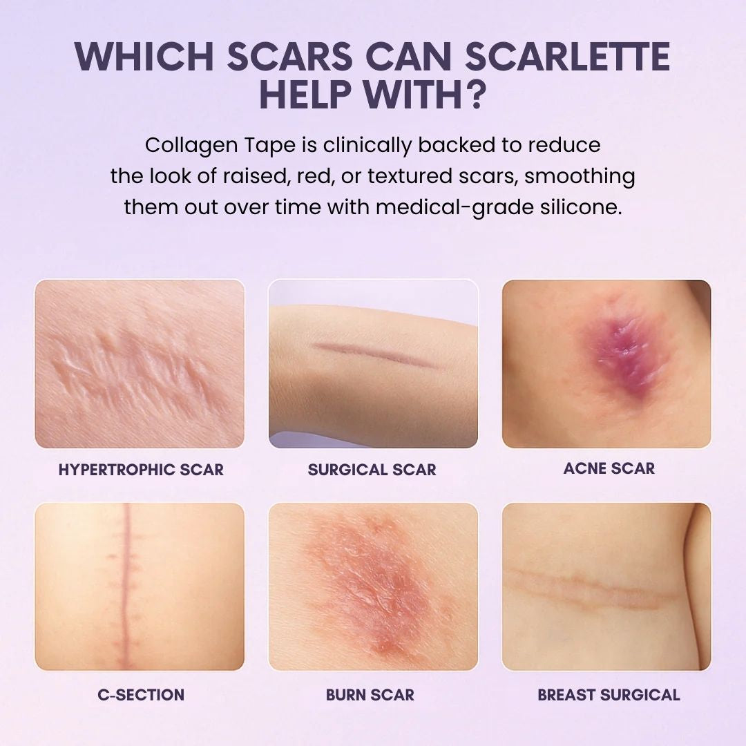 Silicone Collagen Sheets