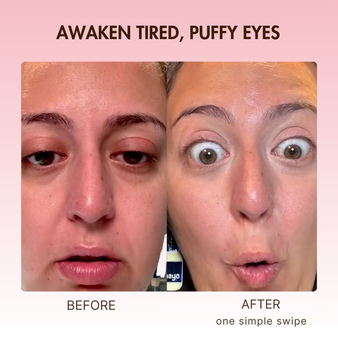 Korean Retinol Under Eye Balm